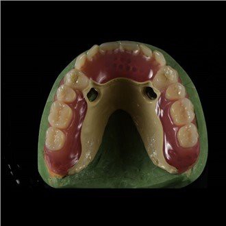Οδοντοστοιχία Peek Framework