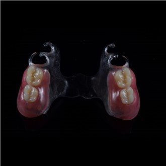 Αφαιρούμενη ακρυλική μερική οδοντοστοιχία