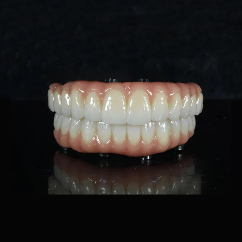ALL-ON -X ZIRCONIA BIDGE